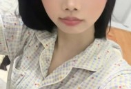21岁女生确诊白血病4个多月后离世，身上曾出现莫名瘀青，医生提醒→